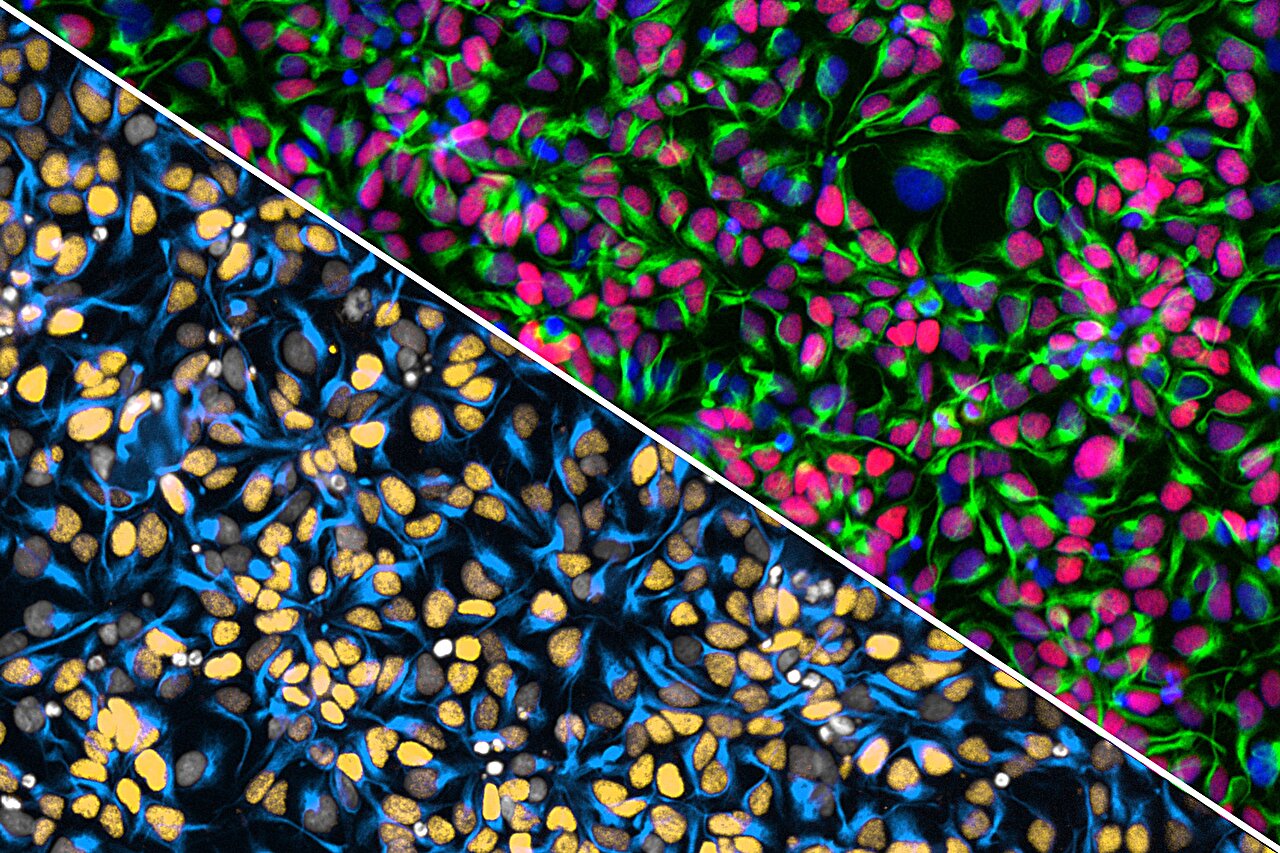Scientists build 'cell villages' to map the genetics of brain cell fitness