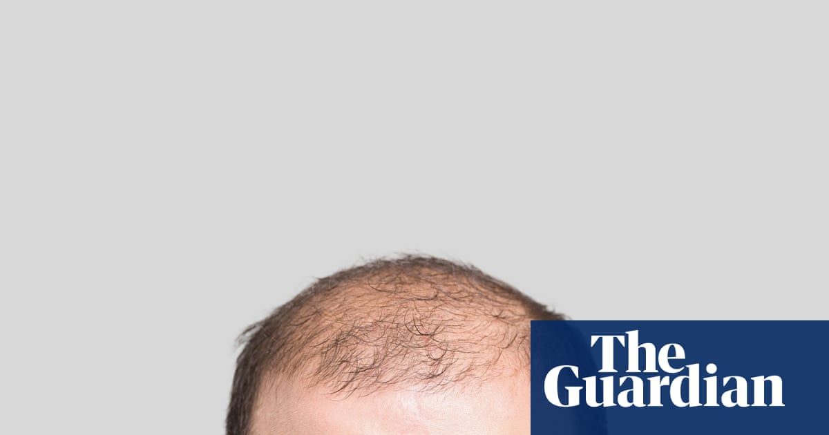 20 fascinating facts about hair: why baldness is super-masculine – and a pubic bush could be a ‘cheating detector’