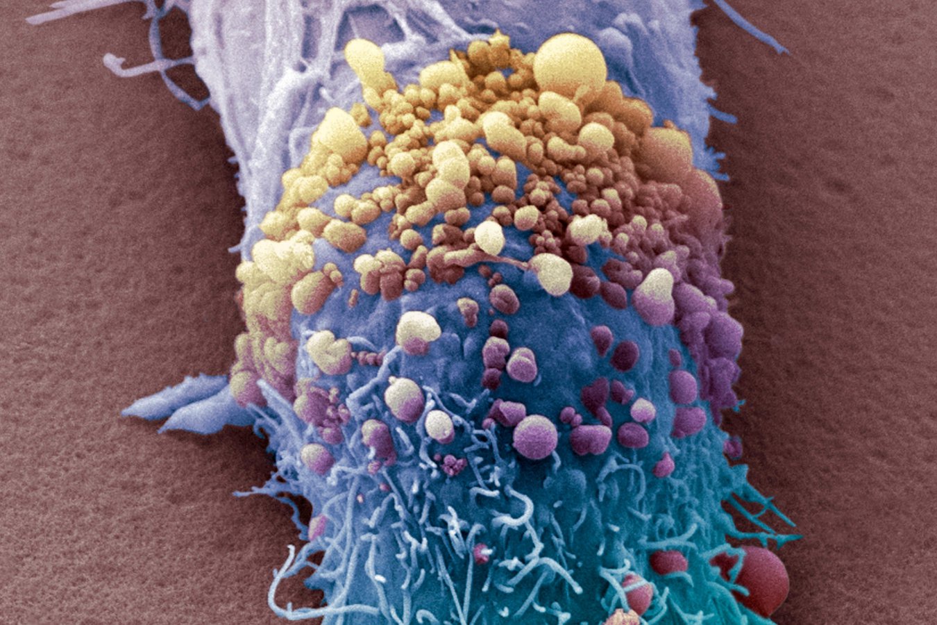 Personalised cancer vaccine expected to be approved next year