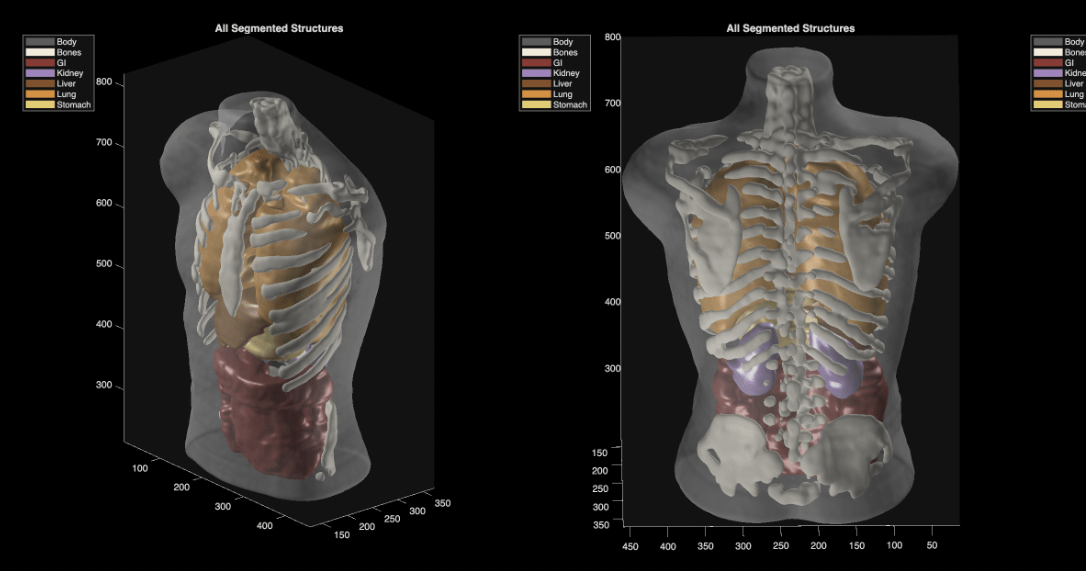 Something’s off with Midjourney’s pivot to body scanners